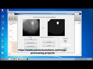 Breast Cancer detection using Neural Networks -Image processing project