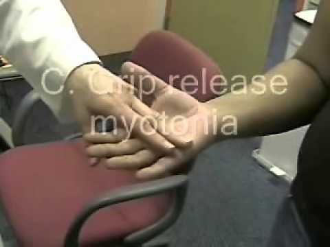 Myotonic Dystrophy | NEJM