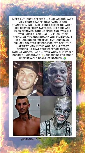 👽 “The Man Who Became The Black Alien” 🚨