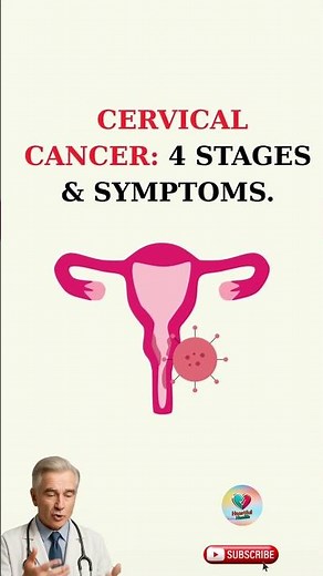 Cervical Cancer Explained: 4 Stages and Symptoms