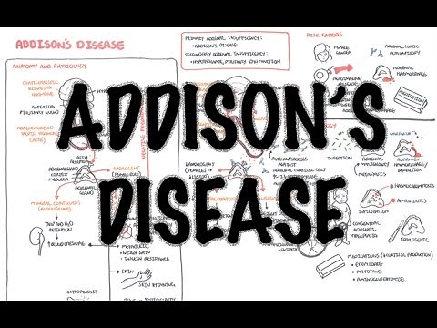 Addison's Disease - Overview (clinical features, pathophysiology, investigations, treatment)