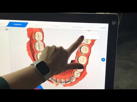 CEREC Primescan using cut tool