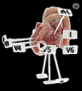 3D ECG Leads: An Interactive 3D approach to the 12 Lead ECG