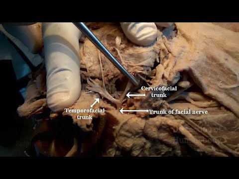 Parotid Gland II - Structures within