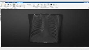 Simplify medical image segmentation—no complex coding required ✅ Import medical imaging data from DICOM, NIfTI, or NRRD files ✅ View images slice by slice in transverse, sagittal, and coronal planes or in 3D ✅ Segment & Label images manually or with tools like Active Contours & Super Pixels ✅ Customize workflows with deep learning & image processing techniques ✅ Export labeled volumes for diagnostic and radiomics applications Learn more: https://spr.ly/6180FDZuQ | MATLAB