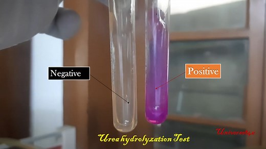 Urea hydrolyzation Test: Principle, Procedure, Interpretation,