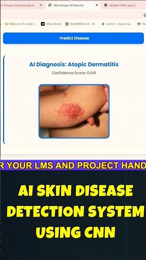 AI Skin Cancer Detection Using CNN | Skin Cancer Detection Using Deep Learning