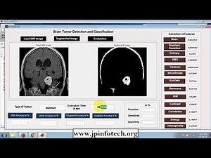 Brain tumor detection and classification | MATLAB Final Year Project