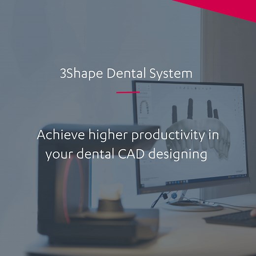3Shape Dental System – 最新のラボ向けCADソフトウェア