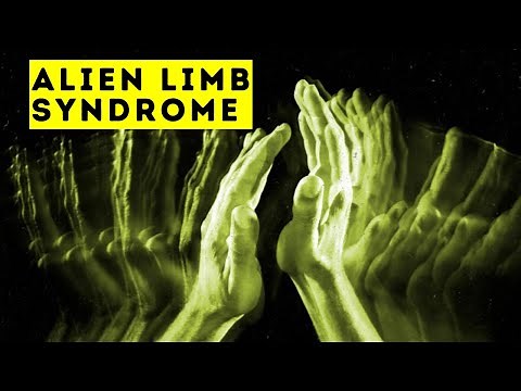 Alien Hand Syndrome - Bizarre Condition Explained - Mental Health Documentary