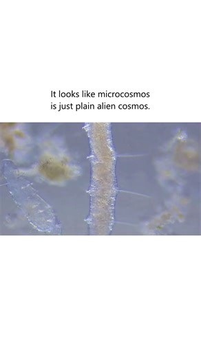 Microcosmos is just alien cosmos. #microscopy #biology #nature #shorts