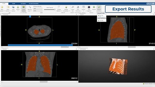 Display, Segment, and Process Medical Imaging Data with MATLAB