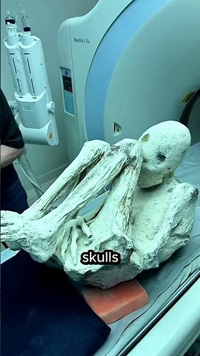 Are These Mummies Alien Or Human?