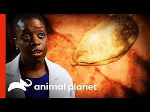 Parasite Eats Man's Lung Tissue | Monsters Inside Me