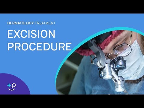 Excision Overview and Procedure [Dermatology]