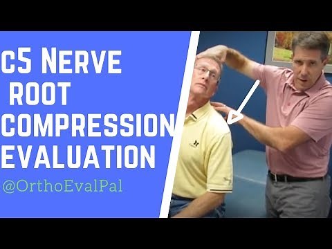 C5 Nerve Root Compression Evaluation