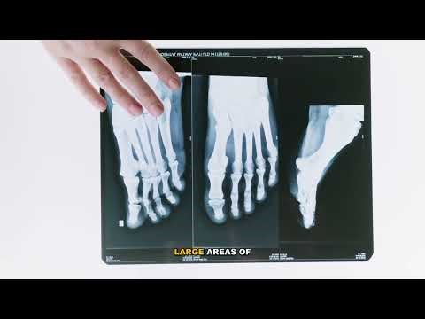 Complete Guide to Run-Length Encoding - Everything You Need to Know