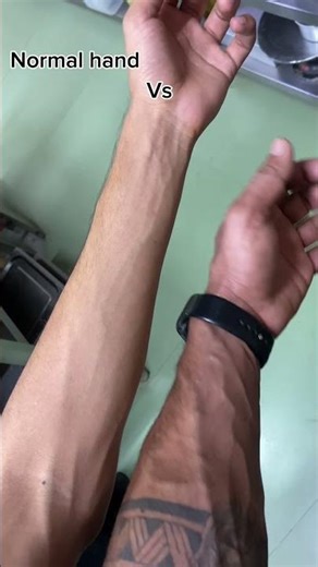 Normal hand vs gym boy hand #motivation #fitneess #gymexercises #gymmotiuationoideo #workoutsession