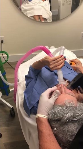 Morpheus 8 Procedure By Dr. Thomas Romo III