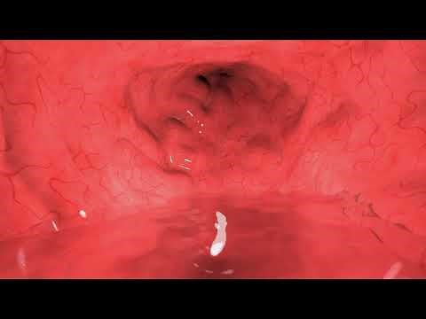 Ambient Gurgles - Ultimate Sleep Audio