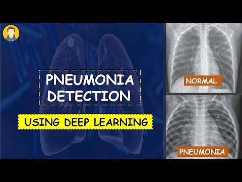 PNEUMONIA Detection Using Deep Learning in Tensorflow, Keras & Python | KNOWLEDGE DOCTOR |