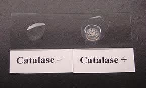 Catalase test: Principle, Procedure, Results, Uses | Microbe Online
