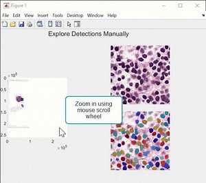 MATLAB now includes the Cellpose library, enhancing our cell segmentation capabilities for pathology and microscopy images. This integration makes it easier to work with Cellpose models and apply them to high-resolution whole slide images. Start experimenting with this step-by-step guide 👉 http://spr.ly/6188wzE7p #Pathology #Microscopy | MATLAB