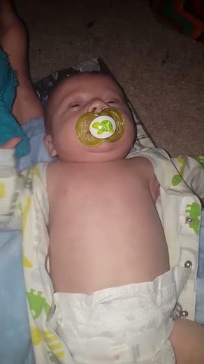 RSV retractions in infant