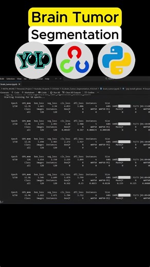 🧠 Brain Tumor Segmentation using YOLOv9 | Medical AI 🚀 #computervision #automobile #deeplearning