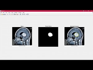 Brain Tumor Detection using Matlab - Image Processing + GUI step by step
