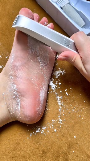（https://temalee.com/product/electric-foot-file.html） Electric foot-operated foot skin grinder efficiently removes dead 角质，gentle without hurting skin! Multiple gears adapt to different foot conditions, long battery life, easy to wash. Solve rough feet easily, keep feet smooth and tender, perfect for home care! #ElectricFootGrinder #FootCareTool #ExfoliatingEssential #PortableFootWash #HomeFootCare | Maura Max Bentley-Murphy