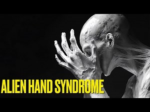 Alien Hand Syndrome: A rare disorder that causes a hand to move involuntarily