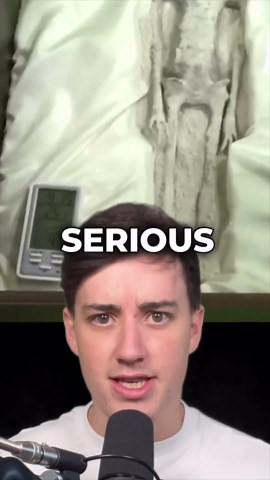 How viral 'alien exposure' stories capture attention